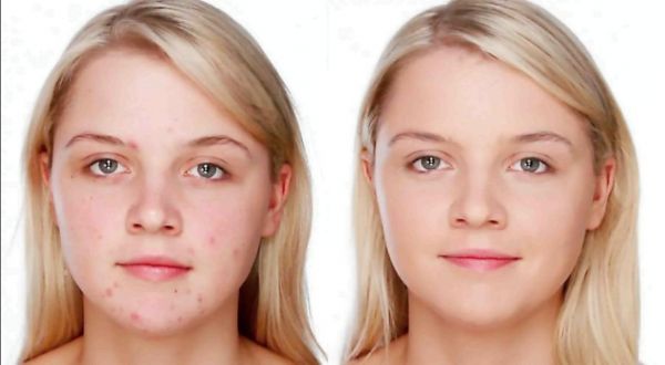 Рейтинг лучших СС-кремов ТОП 2022 года